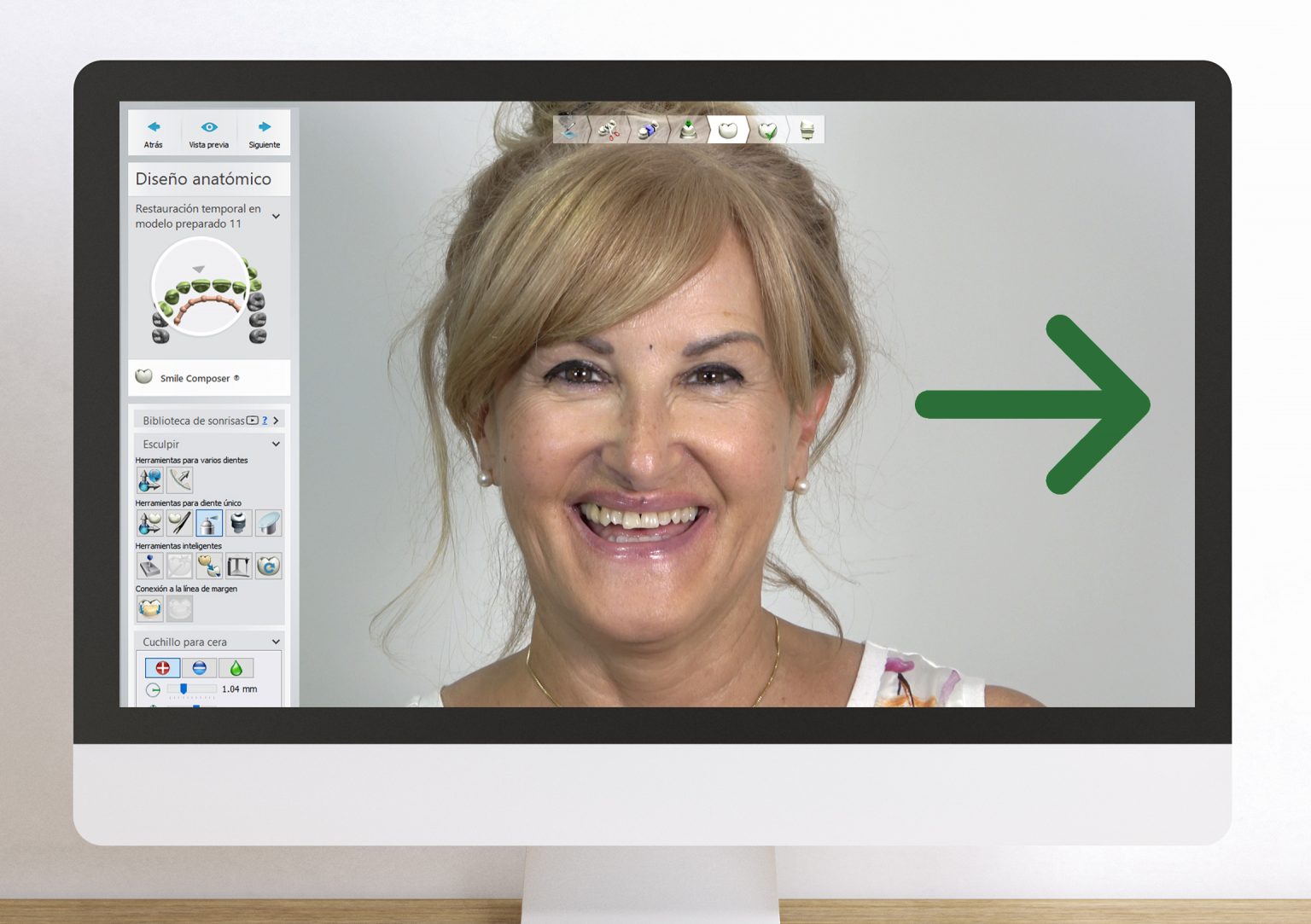 diseño sonrisa01