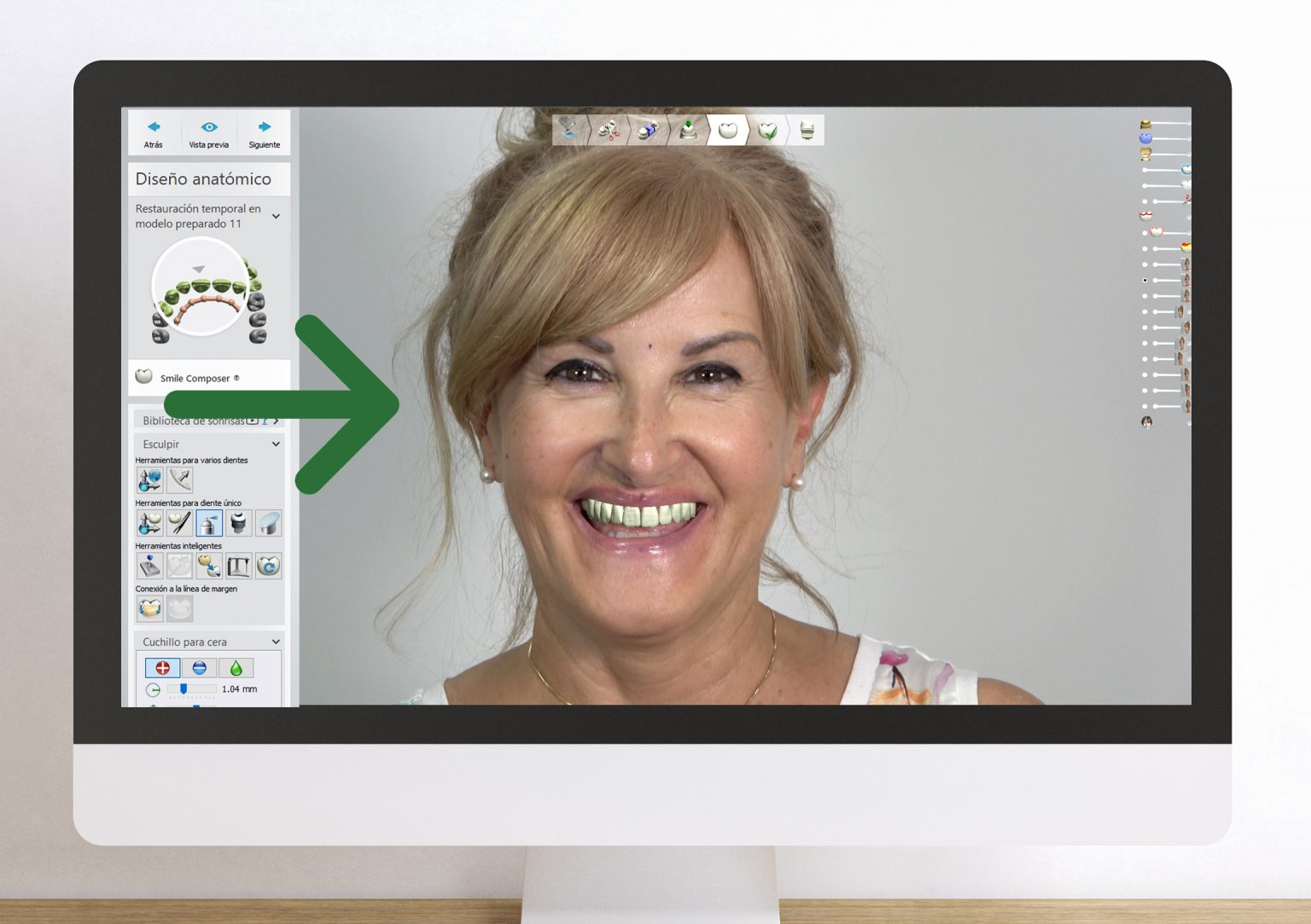 diseño sonrisa02